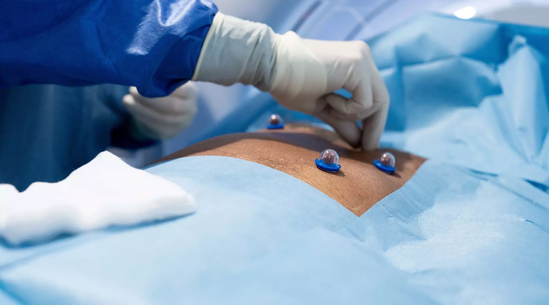 Premier prix pour la radiologie interventionnelle