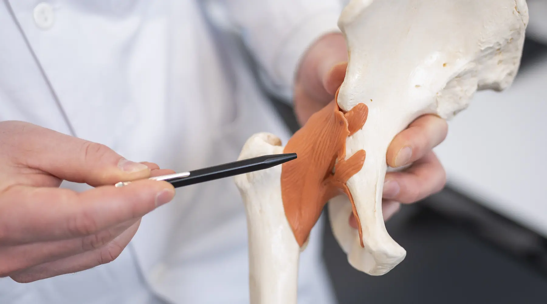 Bloc-PENG-ortho-hanche