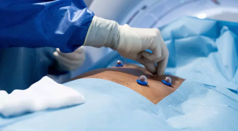 Radiologie CAScination