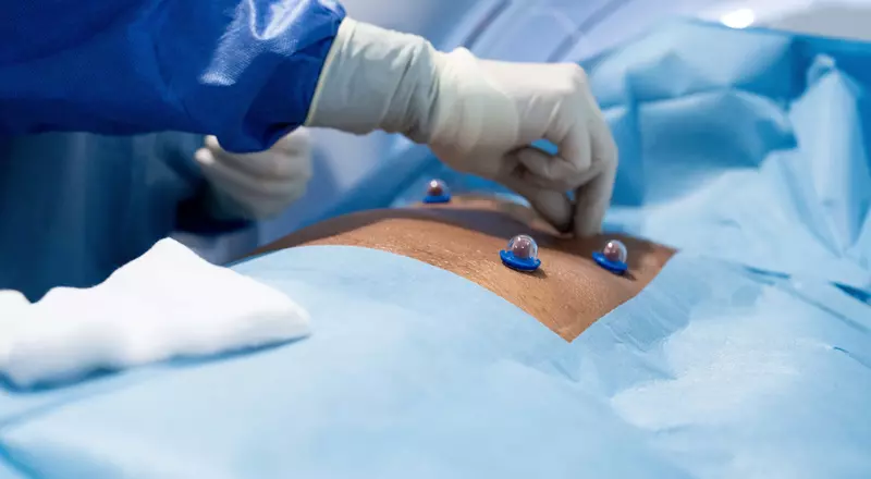 Premier prix pour la radiologie interventionnelle
